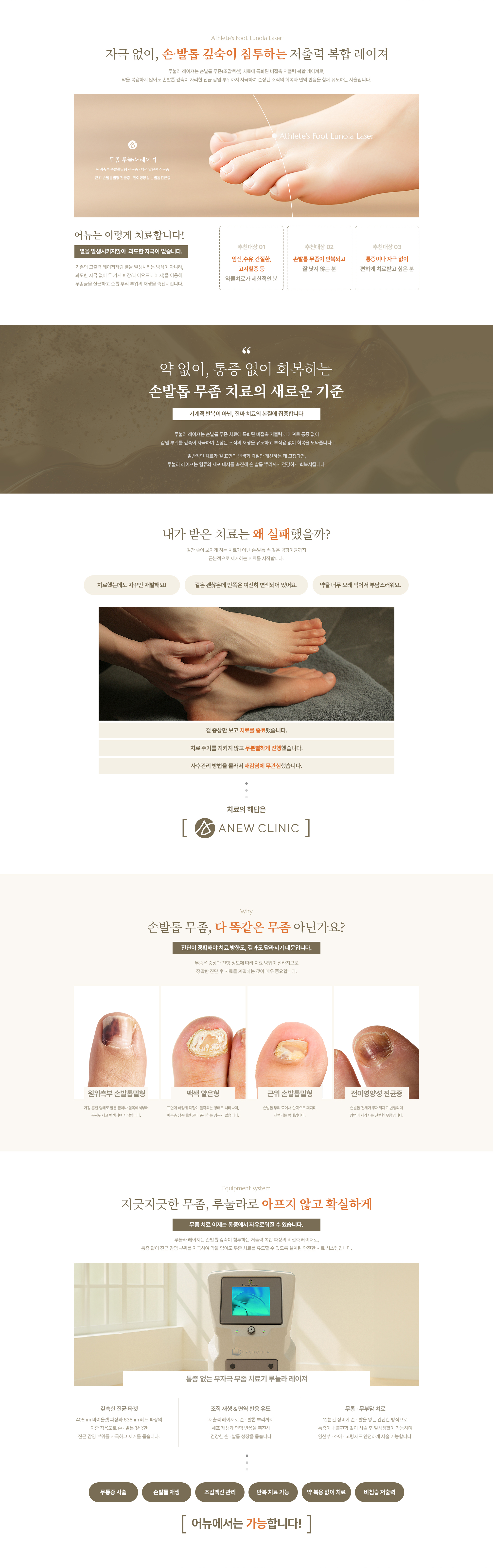 무좀 루눌라 레이져