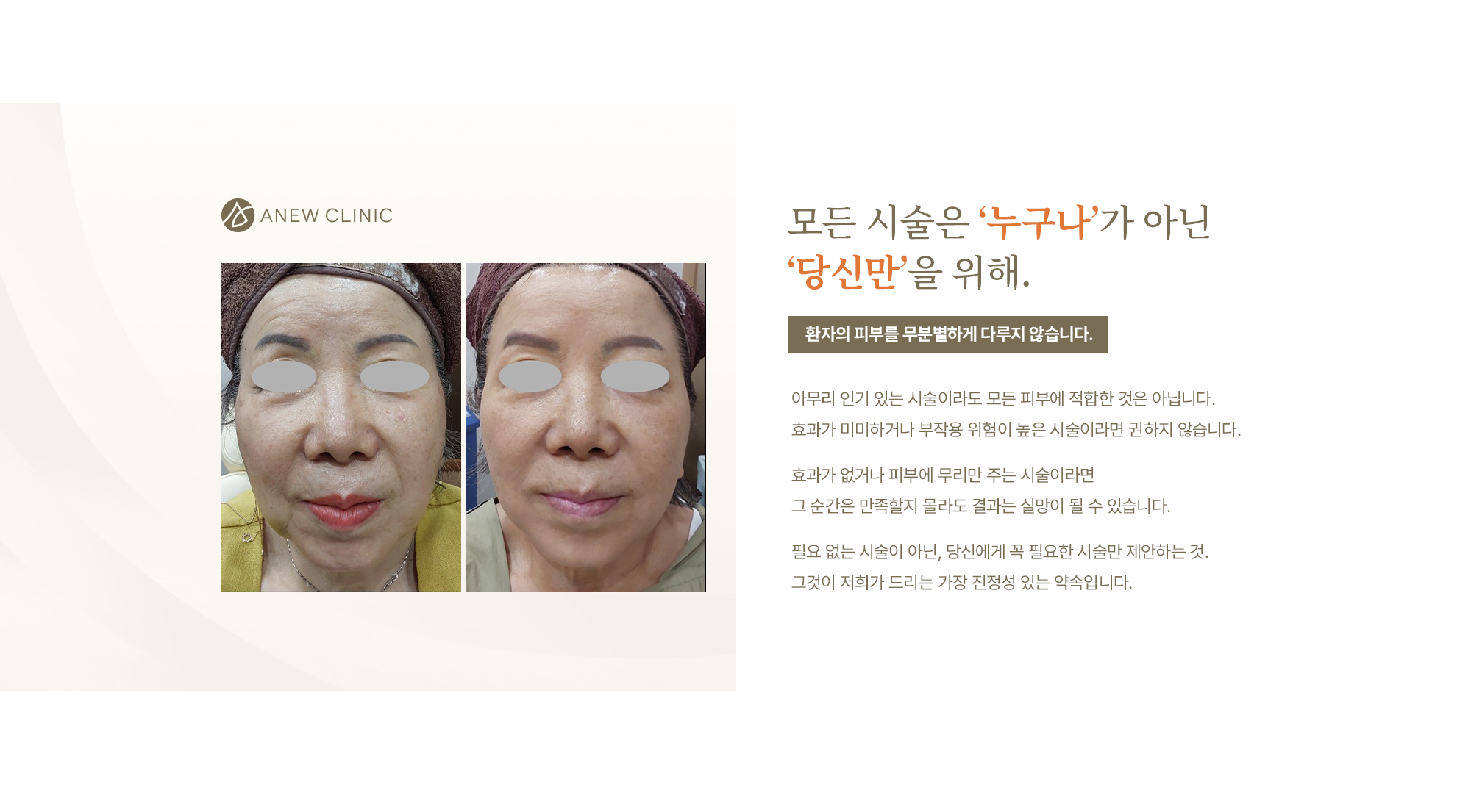 처짐 / 꺼짐